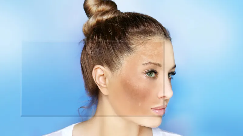 Nắng nóng và gió có thể khiến làn da trở nên sạm màu