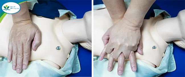 Kỹ thuật ép tim ngoài lồng ngực giúp duy trì tuần hoàn máu khi tim ngừng đập