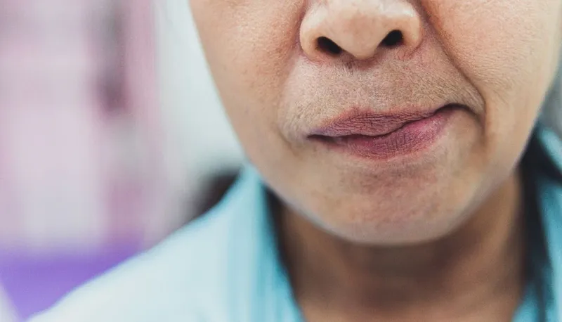 Nhận biết dấu hiệu tai biến qua quy tắc FAST để sơ cứu kịp thời