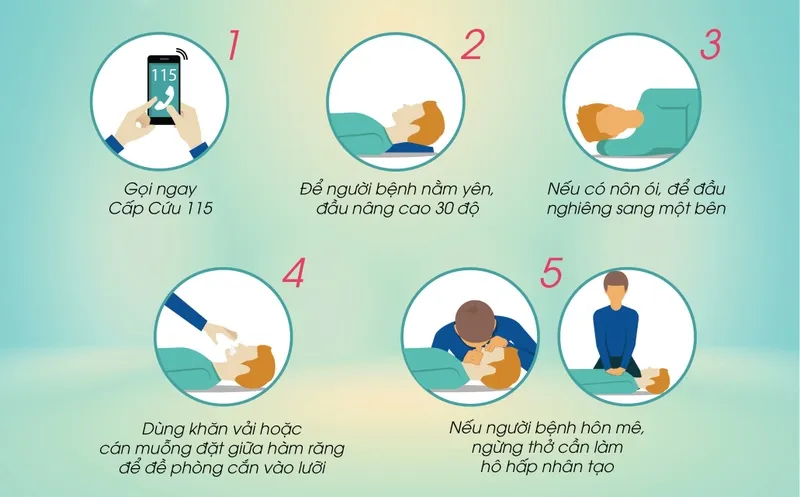 Tư thế nằm nghiêng an toàn khi sơ cứu người bị tai biến