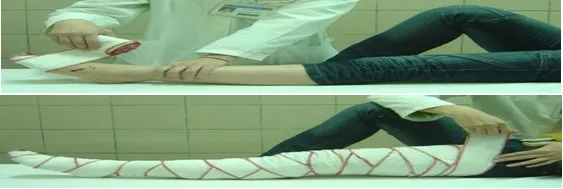 Kỹ thuật băng ép bất động