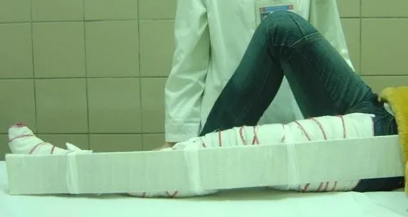 Cố định bằng nẹp