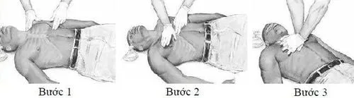 Kỹ thuật ép tim ngoài lồng ngực đúng cách